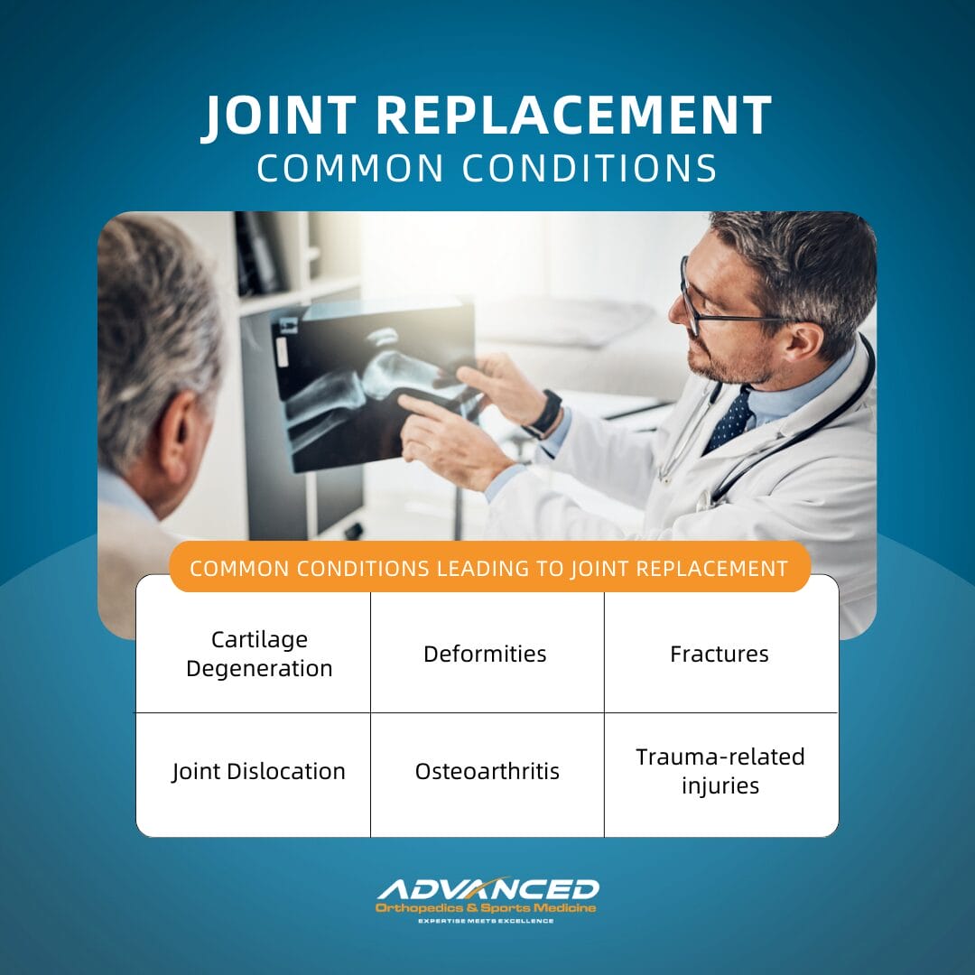 Joint Replacement